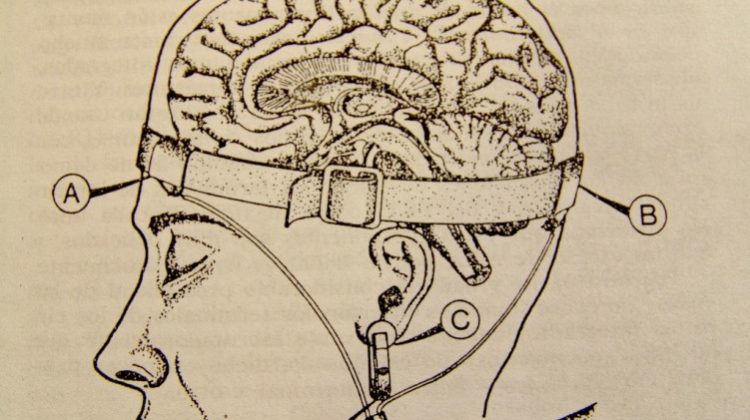Neuromarketing? Ask Me What You Want to Know. Part 1: EEG